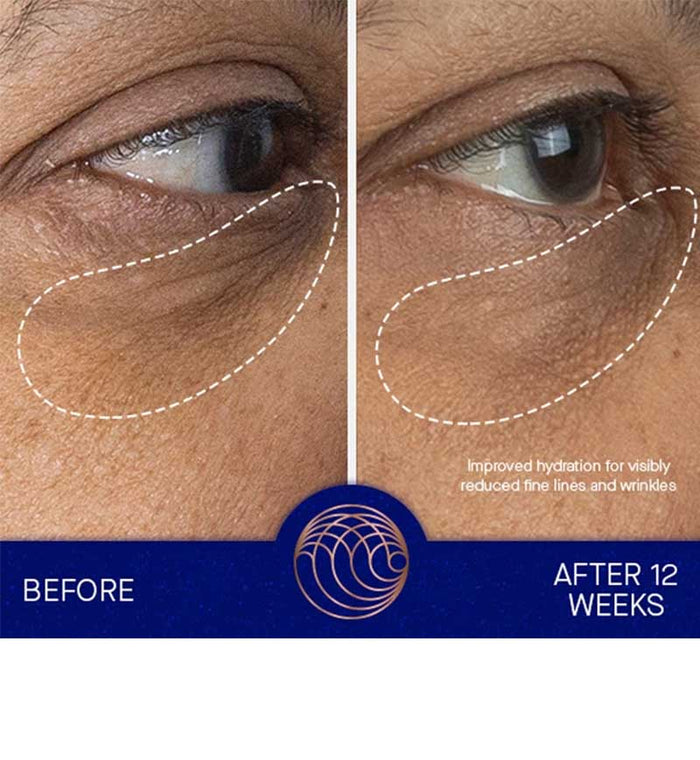 The Eye Cream Full Set - Living with Ivey