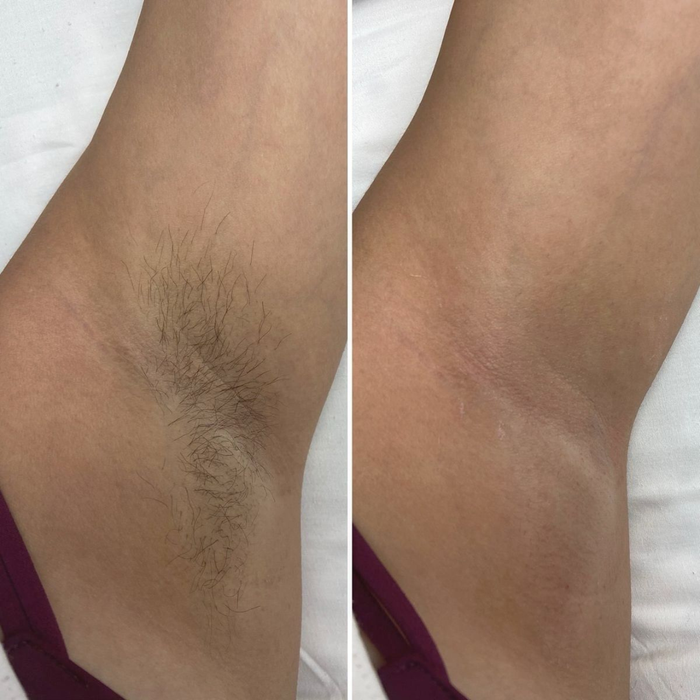 Flamingo Body Hair Removal Cream - Gentle Formula - 200ml - Iris & Suede Scented - Safe Up to 7 Days - Includes Spatula for Touch-Free Application