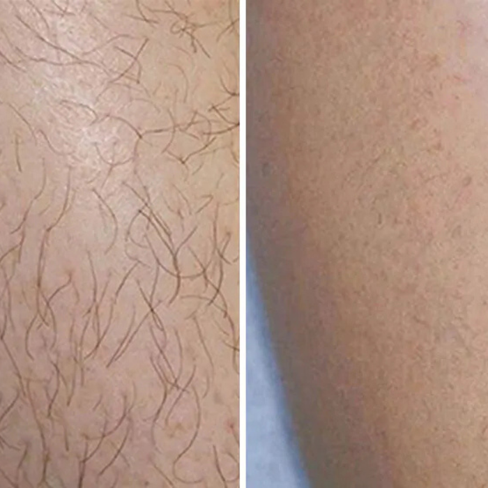 Flamingo Body Hair Removal Cream - Gentle Formula - 200ml - Iris & Suede Scented - Safe Up to 7 Days - Includes Spatula for Touch-Free Application