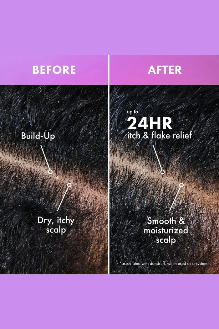 MIELLE LAVENDER & LYCHEE DAILY SCALP MOISTURIZING LOTION MIELLE